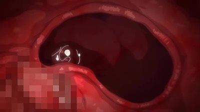 Thumbnail of post image 100