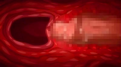 Thumbnail of post image 046
