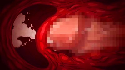 Thumbnail of post image 182