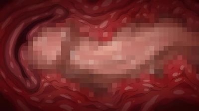 Thumbnail of post image 199